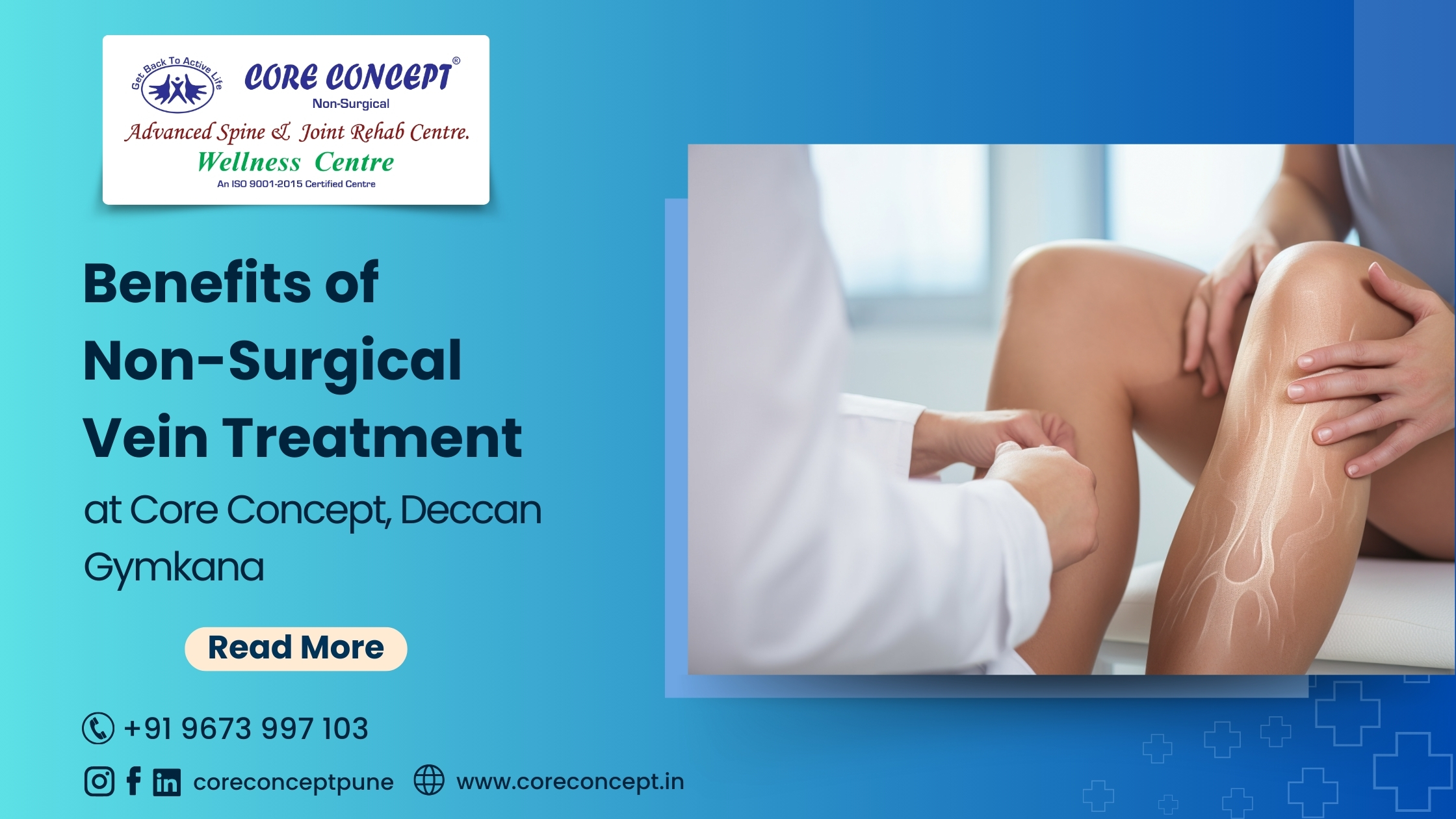 Benefits of Non-Surgical Vein Treatments at Core Concept, Deccan Gymkhana