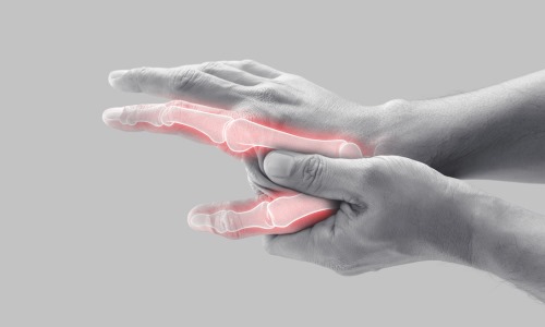  Arthritis Treatments at Core Concept