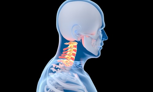 Cervical Vertebra Sprain Treatment at Core Concept