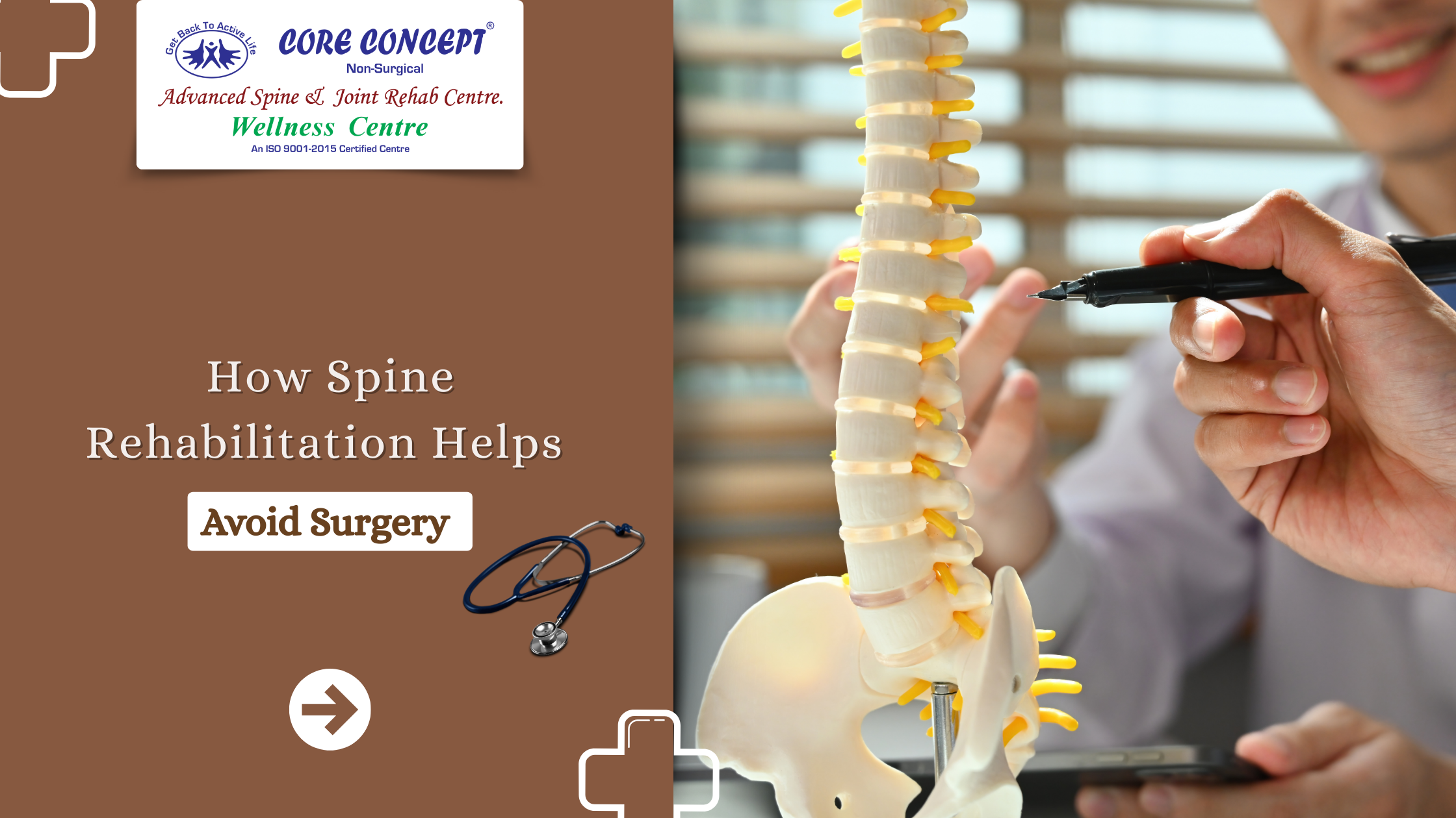 How Spine Rehabilitation Helps Avoid Surgery 