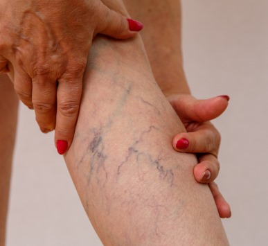 Specializes vein treatment at Core Concept